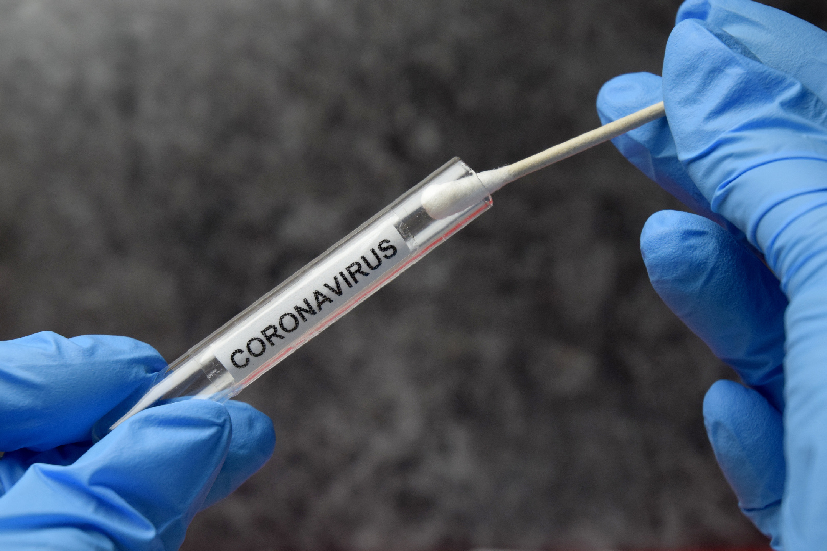 Россиян предупредили о приближении пика заболеваемости коронавирусом