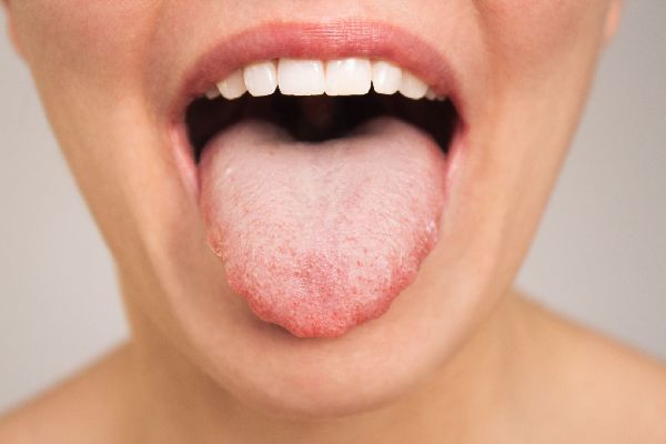 Стало известно, как по языку понять, что с желудком что-то не так